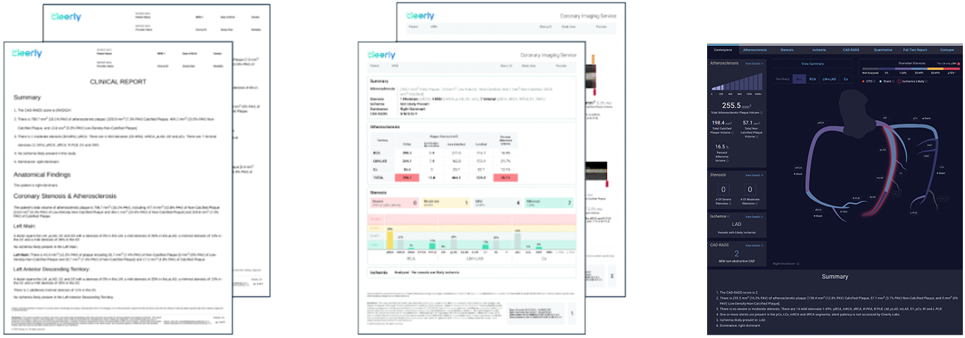 cleerly-insights-screen-heart-technology