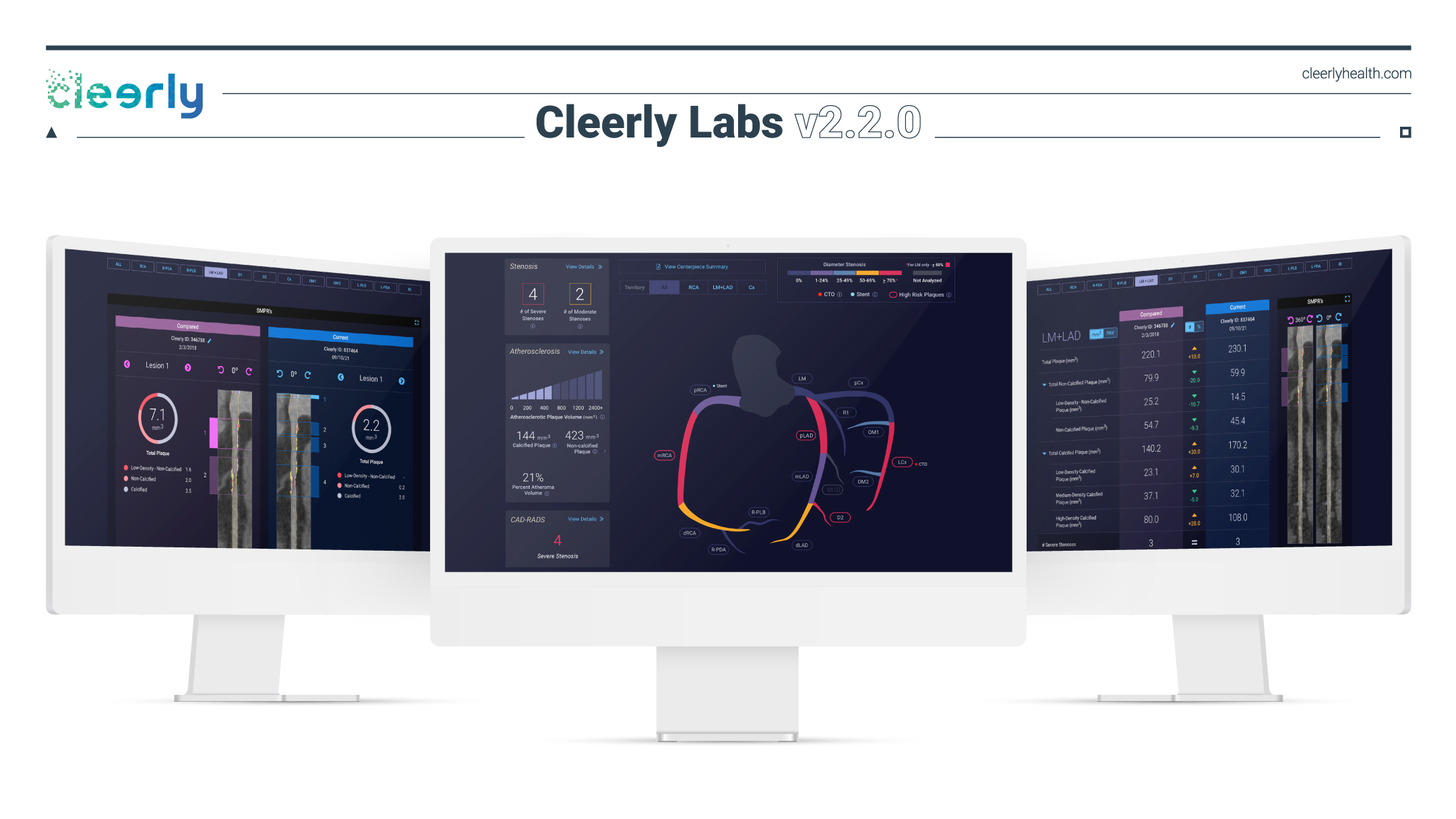 CLEERLY TAKES PRECISION HEART CARE TO THE NEXT LEVEL WITH CLEERLY 2.2.0