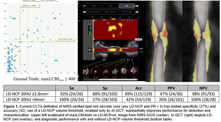 Determination of Lipid-Rich Plaque by Artificial Intelligence-Enabled Quantitative Computed Tomography Using Near Infrared Spectroscopy