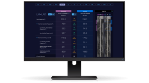 cleerly-labs_plaque-burden_pc