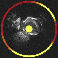 other-methods-nirs