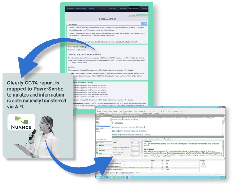 cleerly-website_what-is-cleerly_powerscribe