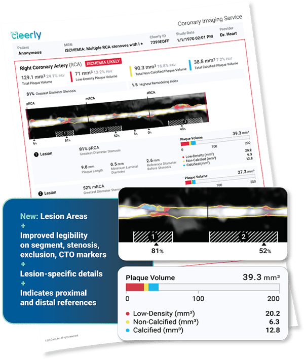 rsna_transparent1_v2