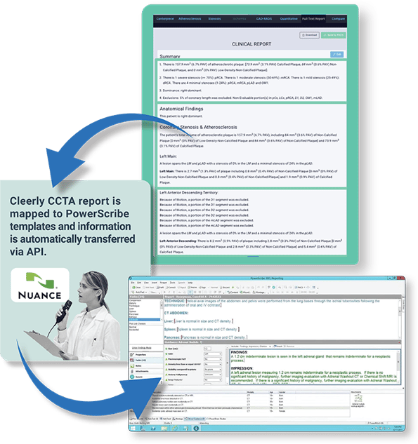 cleerly-website_what-is-cleerly_powerscribe