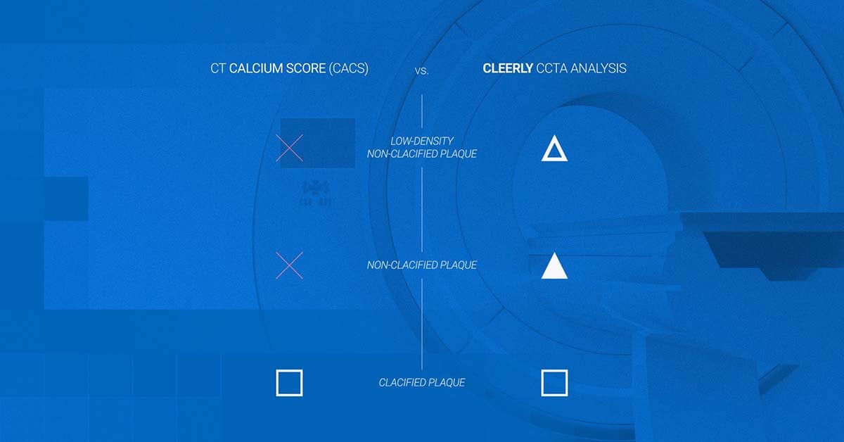 Cleerly Versus Coronary Artery Calcium Score: How the two heart disease tests measure up