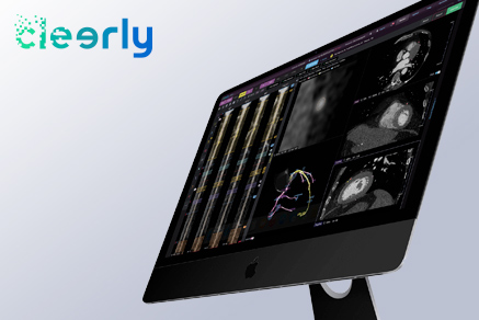 Cleerly-Launches-with-43MM-Series-B