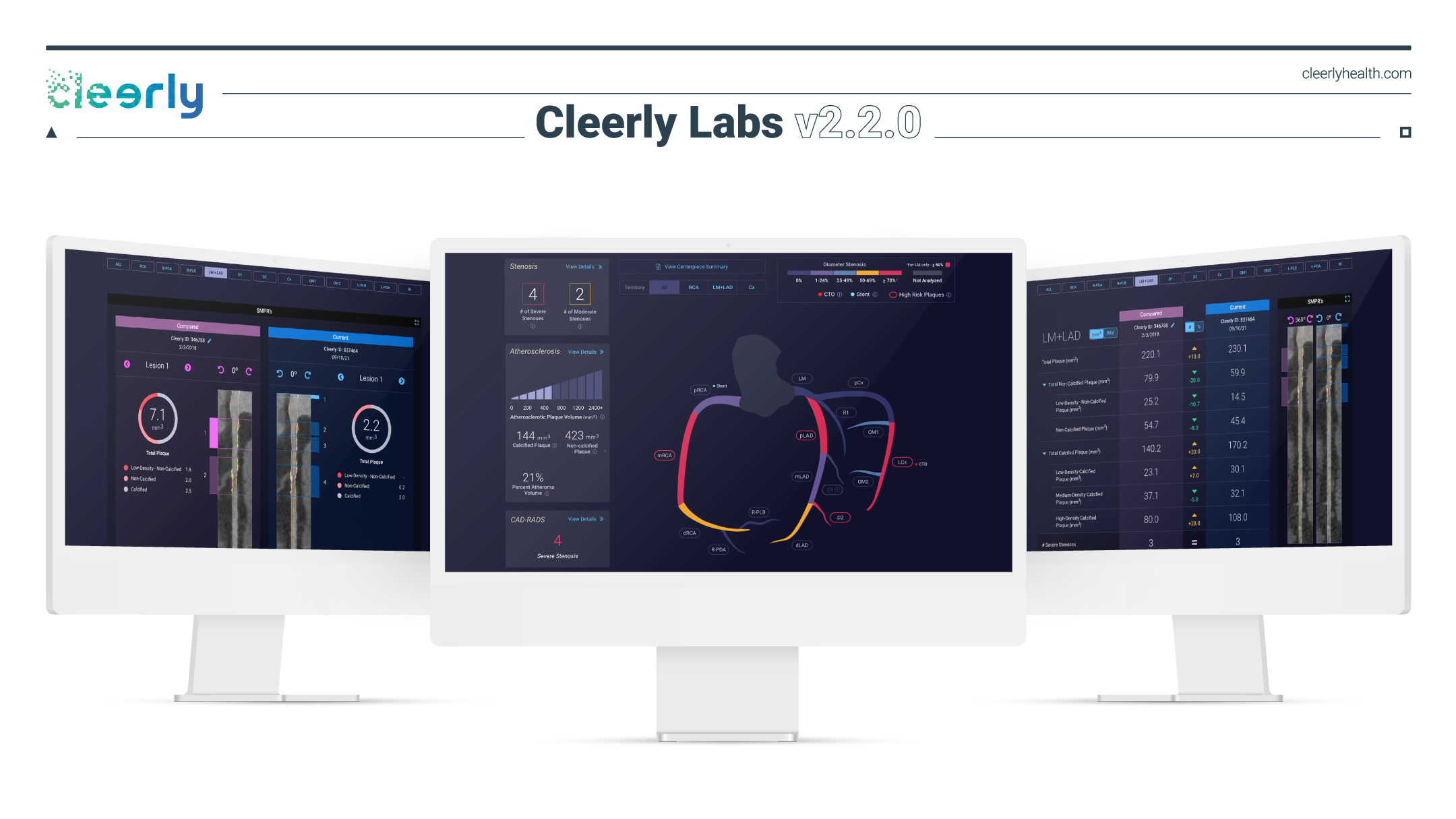 Cleerly Labs: Product Suite (thumbnail)