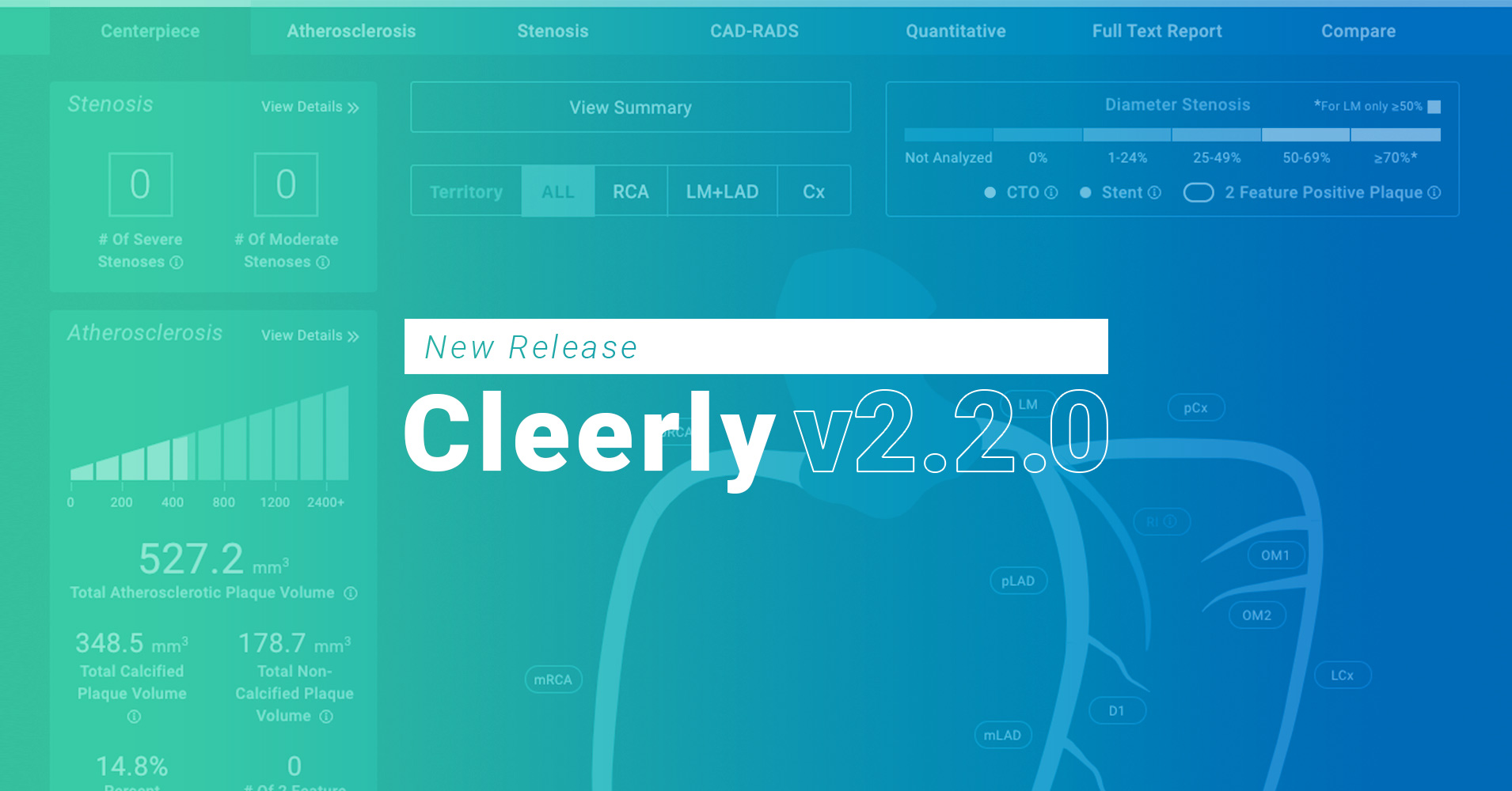 Cleerly Product Release: Taking Precision Heart Care to the Next Level