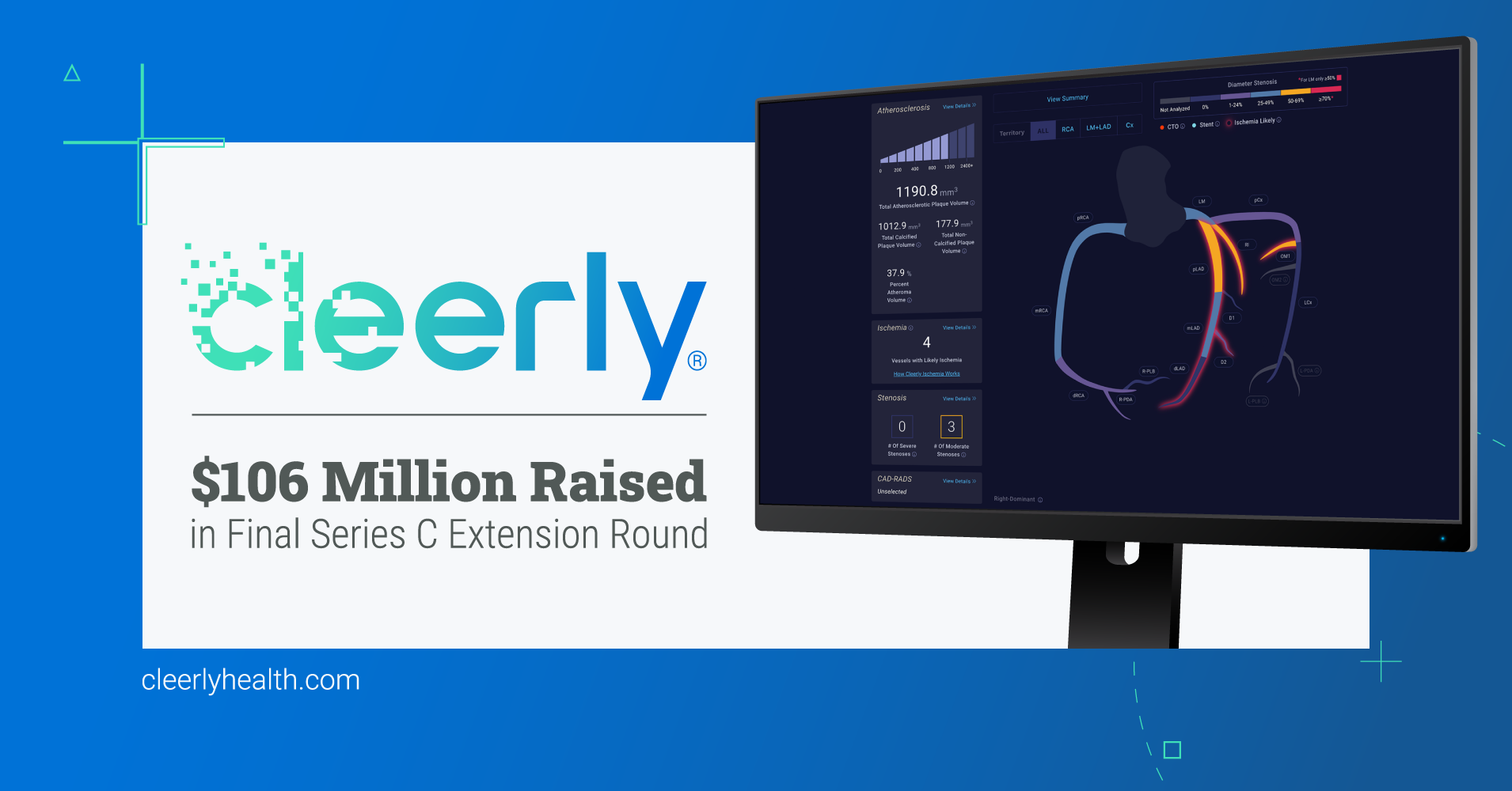 Cleerly Raises $106 Million in Funding Led by Insight Partners to Revolutionize Heart Disease Care