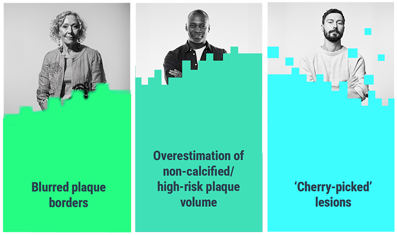 Cleerly COMPARE Coronary Plaque Analysis Cleerly COMPARE Coronary Plaque Analysis